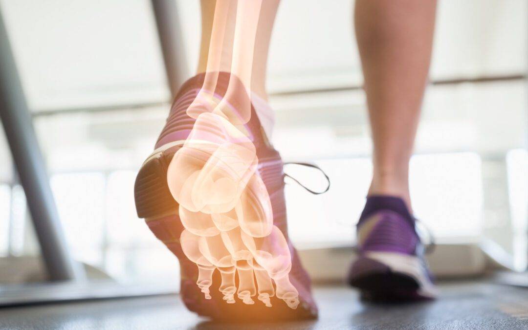 Digital composite of Highlighted foot bones of jogging woman